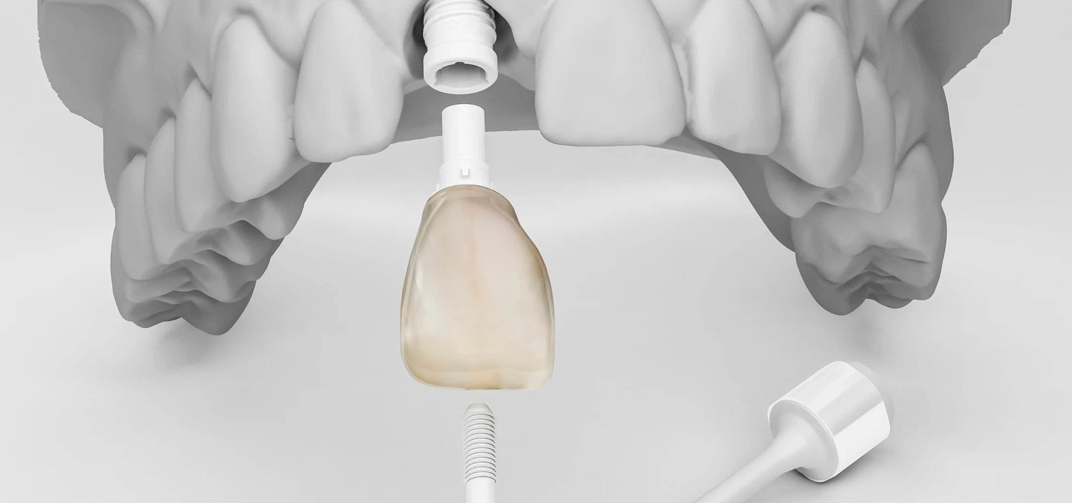 Implant céramique