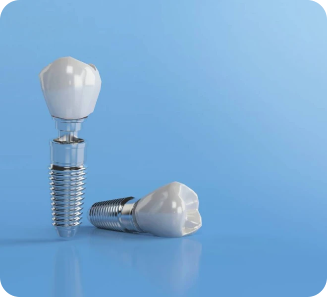 Implant dentaire